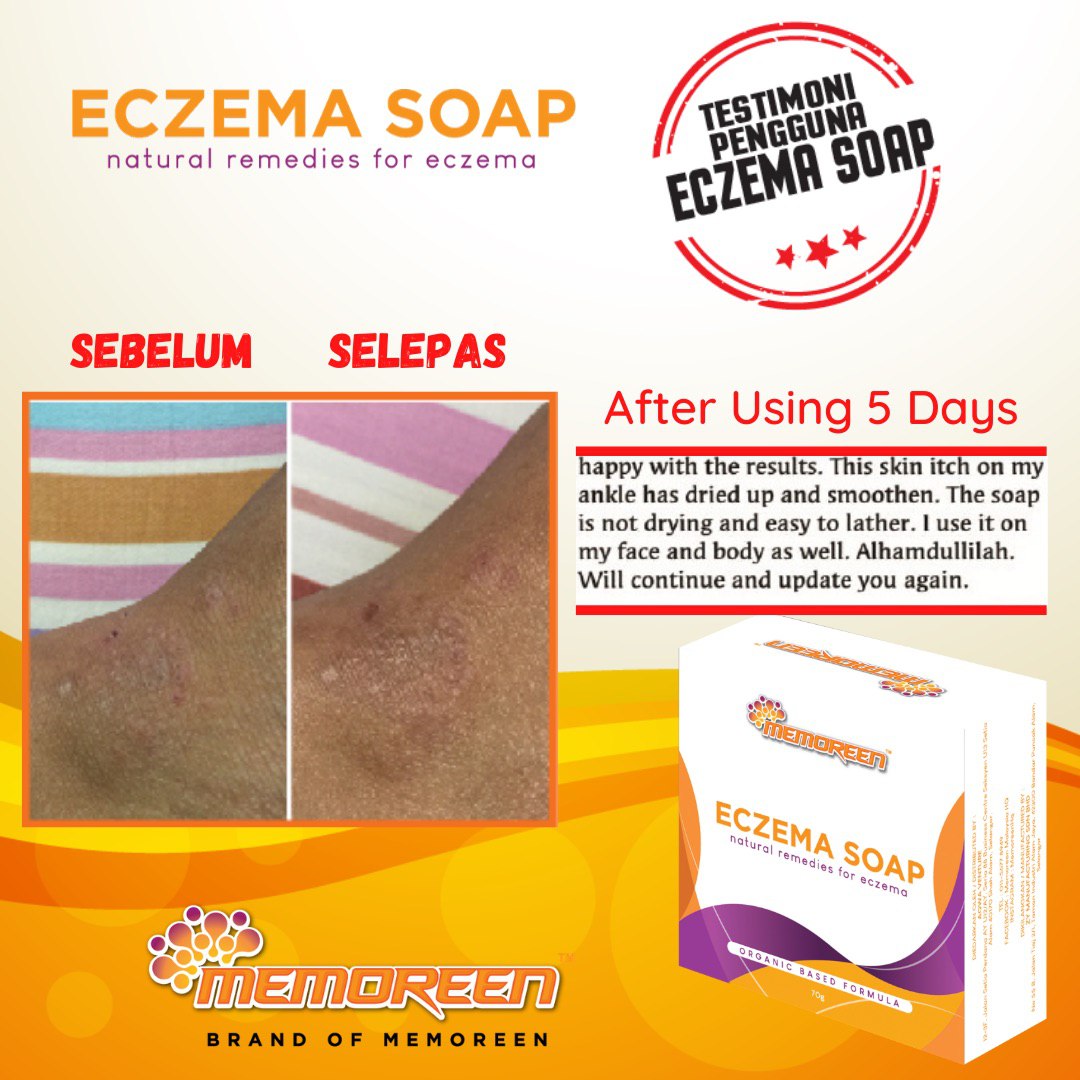 Eczema Soap (8)