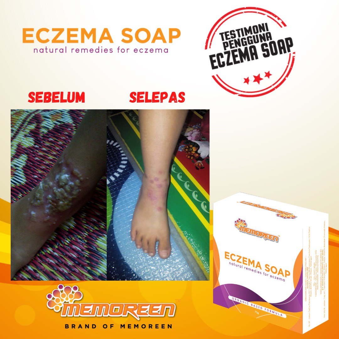 Testimoni Eczema Soap (5)